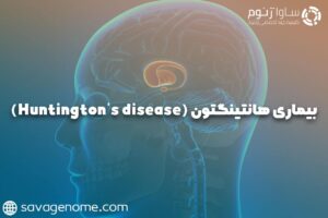 بیماری هانتینگتون (Huntington’s disease)